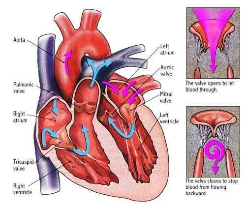 heart valve surgery